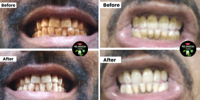 Customer Before After Results